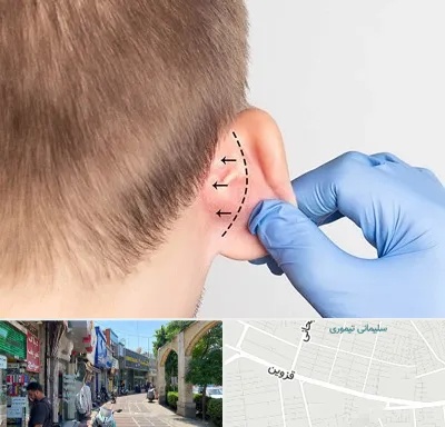 عمل زیبایی گوش در خیابان قزوین