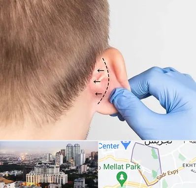 عمل زیبایی گوش در الهیه