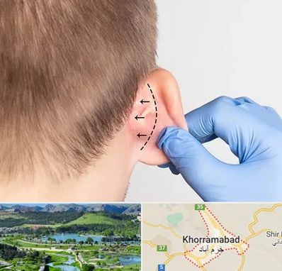 عمل زیبایی گوش در خرم آباد