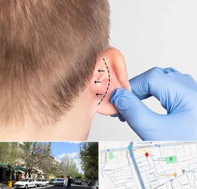 عمل زیبایی گوش در کوی فیروز تبریز