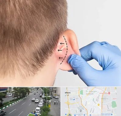 عمل زیبایی گوش در ستارخان