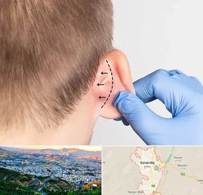 عمل زیبایی گوش در سنندج