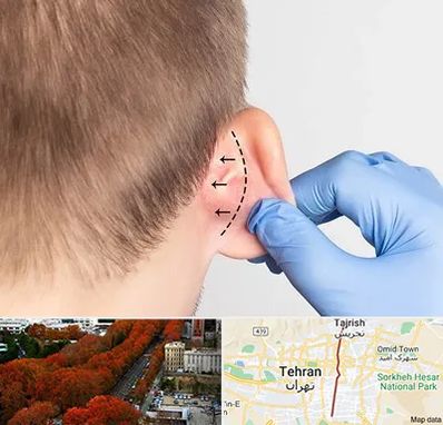 عمل زیبایی گوش در ولیعصر