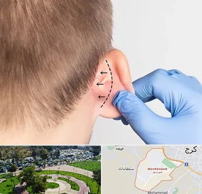عمل زیبایی گوش در مهرشهر کرج