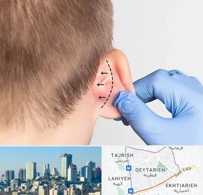 عمل زیبایی گوش در قیطریه