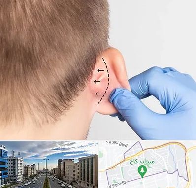 عمل زیبایی گوش در سعادت آباد تهران
