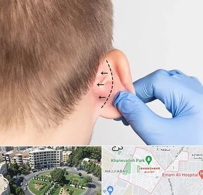 عمل زیبایی گوش در جهانشهر کرج
