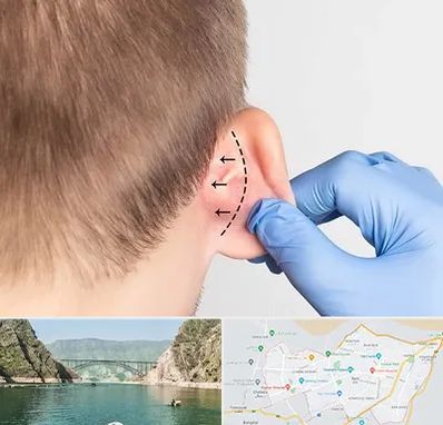 عمل زیبایی گوش در ایلام