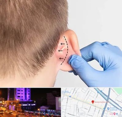 عمل زیبایی گوش در آبرسان تبریز