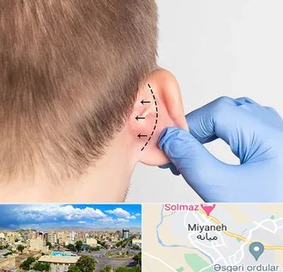 عمل زیبایی گوش در میانه