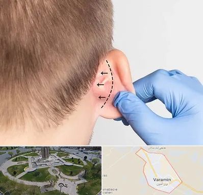 عمل زیبایی گوش در ورامین
