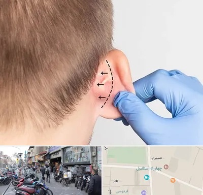 عمل زیبایی گوش در چهارراه استانبول