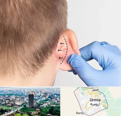 عمل زیبایی گوش در ارومیه
