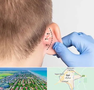عمل زیبایی گوش در ساری