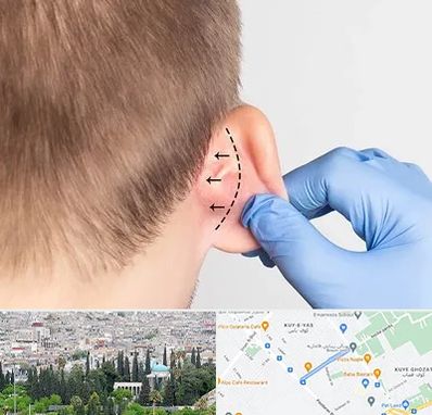 عمل زیبایی گوش در محلاتی شیراز
