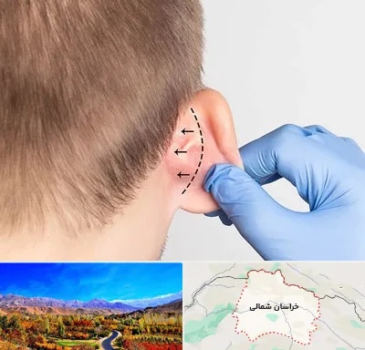 عمل زیبایی گوش در خراسان شمالی
