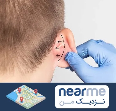 عمل زیبایی گوش در نزدیک من