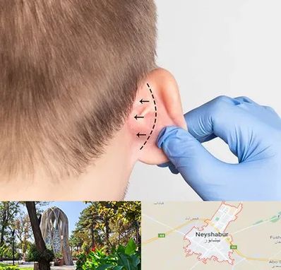 عمل زیبایی گوش در نیشابور