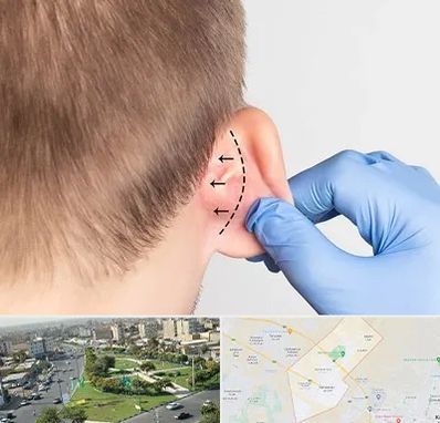 عمل زیبایی گوش در کمال شهر کرج