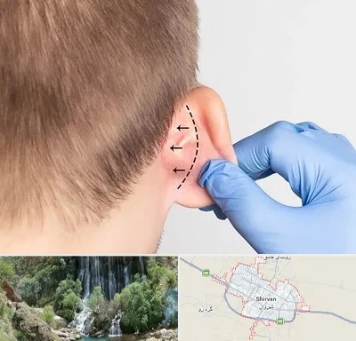 عمل زیبایی گوش در شیروان