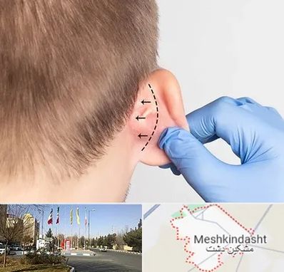 عمل زیبایی گوش در مشکین دشت