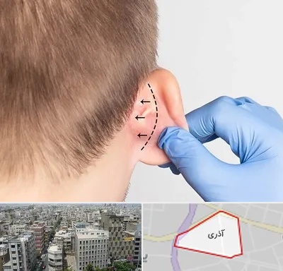 عمل زیبایی گوش در آذری