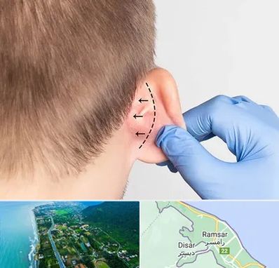 عمل زیبایی گوش در رامسر