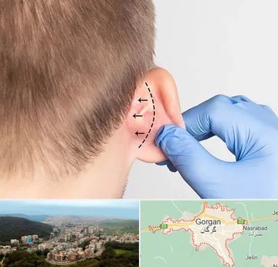 عمل زیبایی گوش در گرگان
