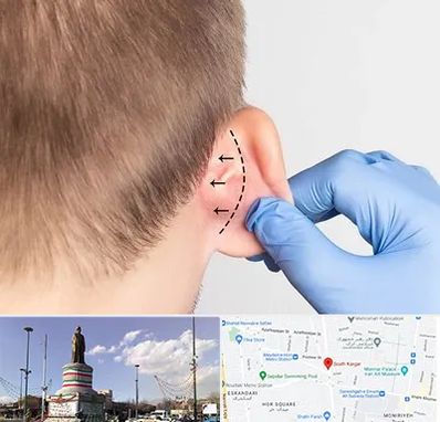 عمل زیبایی گوش در کارگر جنوبی