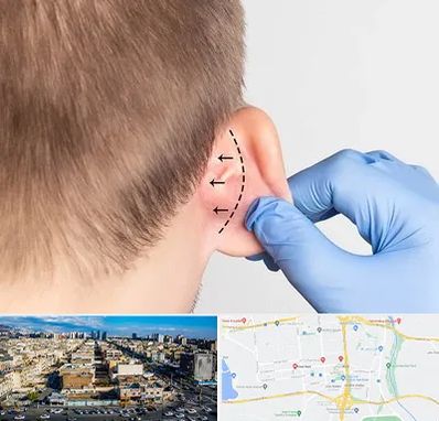 عمل زیبایی گوش در شهرک راه آهن