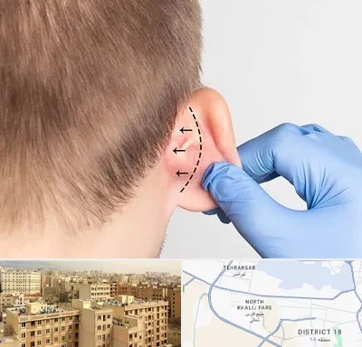 عمل زیبایی گوش در جنوب غرب تهران