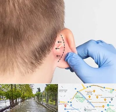 عمل زیبایی گوش در خیابان ارم شیراز