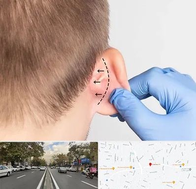 عمل زیبایی گوش در دولت