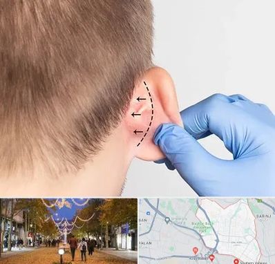 عمل زیبایی گوش در ولیعصر ارومیه