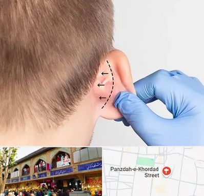 عمل زیبایی گوش در 15 خرداد