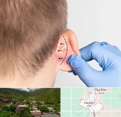 عمل زیبایی گوش در کلاله