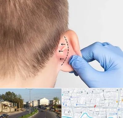 عمل زیبایی گوش در ضیابری رشت