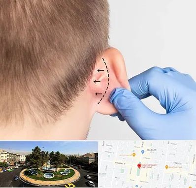 عمل زیبایی گوش در هفت حوض