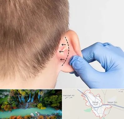 عمل زیبایی گوش در دورود