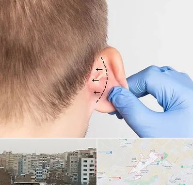 عمل زیبایی گوش در محمد شهر کرج