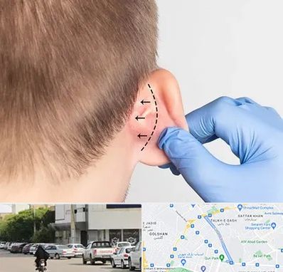 عمل زیبایی گوش در قدوسی شرقی شیراز