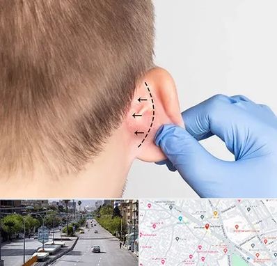 عمل زیبایی گوش در خیابان زند شیراز