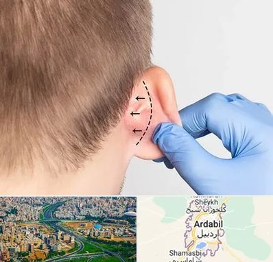 عمل زیبایی گوش در اردبیل