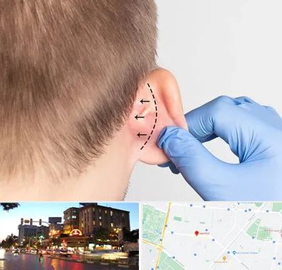 عمل زیبایی گوش در بلوار سجاد مشهد