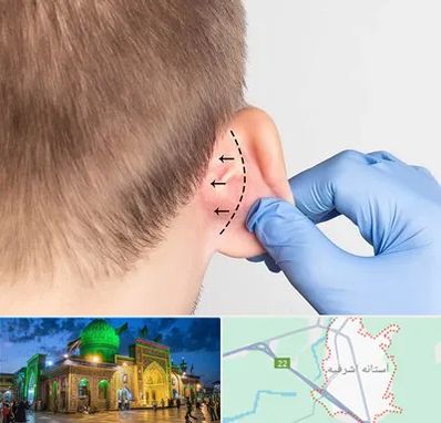 عمل زیبایی گوش در آستانه اشرفیه