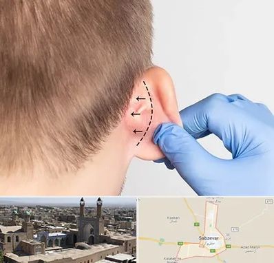 عمل زیبایی گوش در سبزوار