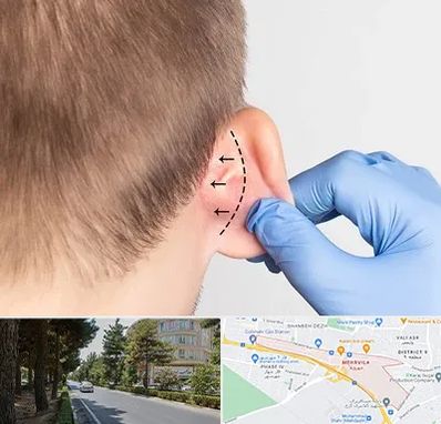 عمل زیبایی گوش در مهرویلا کرج