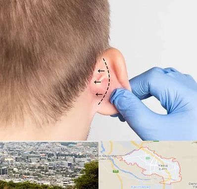 عمل زیبایی گوش در یاسوج