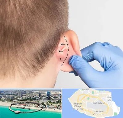 عمل زیبایی گوش در کیش