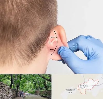 عمل زیبایی گوش در شاندیز مشهد